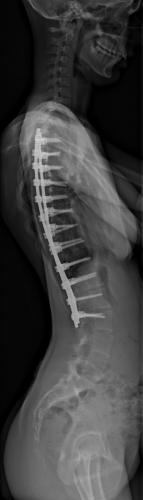 Radio à 1 an de recul de Profil