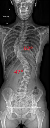Radio pré-opératoire de Face