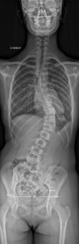 Radio préopératoire de Face