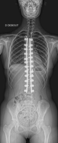 Radio de Face à 2 ans de recul