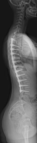 Radio de Profil à 2 ans de recul